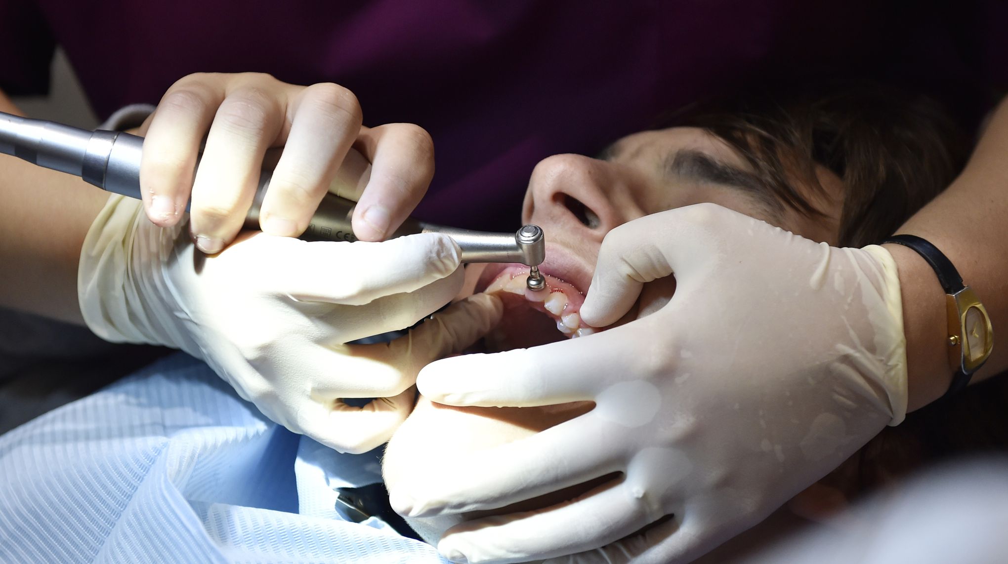 Les domaines d'intervention d'un parodontologue