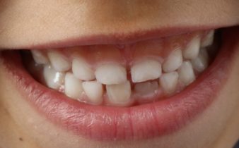 Comment garder votre bouche et vos dents en bonne santé 