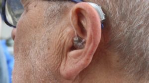 Prothèse auditive : savoir détecter quand elle devient indispensable