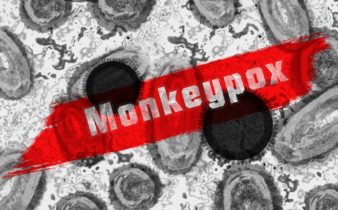 Variole du singe / Monkeypox : Symptômes, causes et traitement.