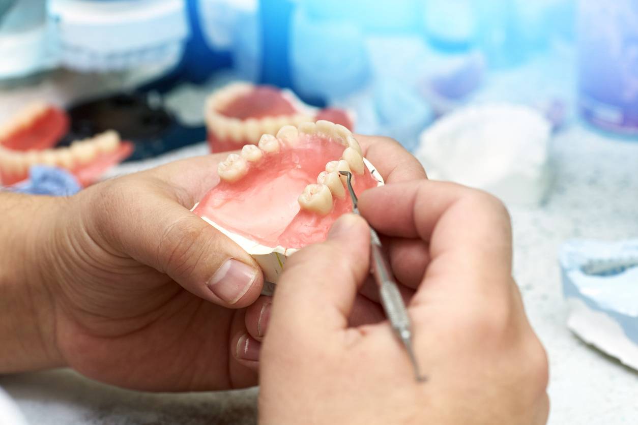 bridge sur implant dentiste