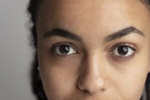 Cernes : causes et solutions efficaces pour les atténuer