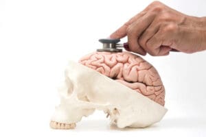 Cancer du cerveau ? Causes et risques réels.