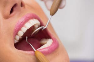 Pourquoi la qualité des instruments de votre dentiste compte pour votre bien-être.